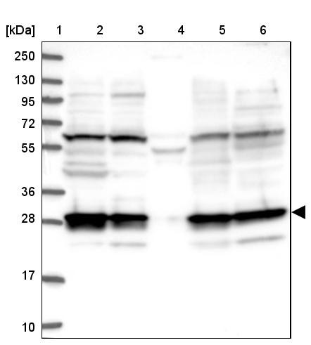 Lane 1: Marker [kDa] 250, 130, 95, 72, 55, 36, 28, 17, 10<br/>Lane 2: Human cell line RT-4<br/>Lane 3: Human cell line U-251MG sp<br/>Lane 4: Human plasma (IgG/HSA depleted)<br/>Lane 5: Human liver tissue<br/>Lane 6: Human tonsil tissue