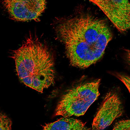 Immunofluorescent staining of human cell line U-251 MG shows localization to endoplasmic reticulum.