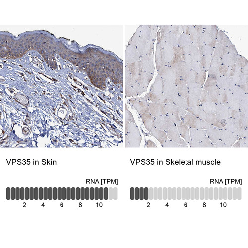 Immunohistochemistry analysis in human skin and skeletal muscle tissues using HPA040802 antibody. Corresponding VPS35 RNA-seq data are presented for the same tissues.