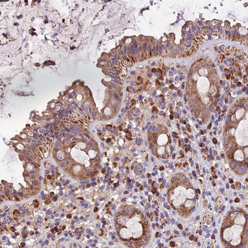 Immunohistochemical staining of human rectum shows moderate cytoplasmic positivity in glandular cells.