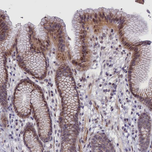 Immunohistochemical staining of human stomach shows moderate cytoplasmic positivity in glandular cells.