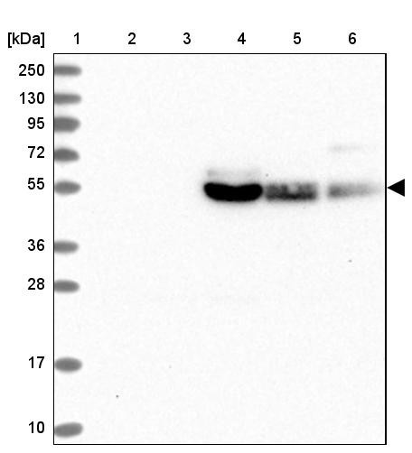 Lane 1: Marker [kDa] 250, 130, 95, 72, 55, 36, 28, 17, 10<br/>Lane 2: Human cell line RT-4<br/>Lane 3: Human cell line U-251MG sp<br/>Lane 4: Human plasma (IgG/HSA depleted)<br/>Lane 5: Human liver tissue<br/>Lane 6: Human tonsil tissue