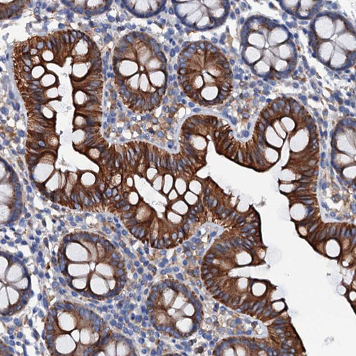 Immunohistochemical staining of human Colon shows moderate membranous positivity in glandular cells.