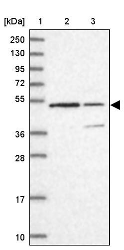 Lane 1: Marker [kDa] 250, 130, 95, 72, 55, 36, 28, 17, 10<br/>Lane 2: Human cell line RT-4<br/>Lane 3: Human cell line U-251MG sp
