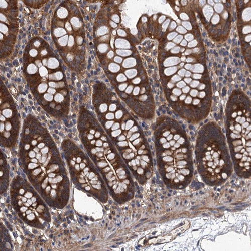 Immunohistochemical staining of human colon shows strong cytoplasmic positivity in glandular cells.