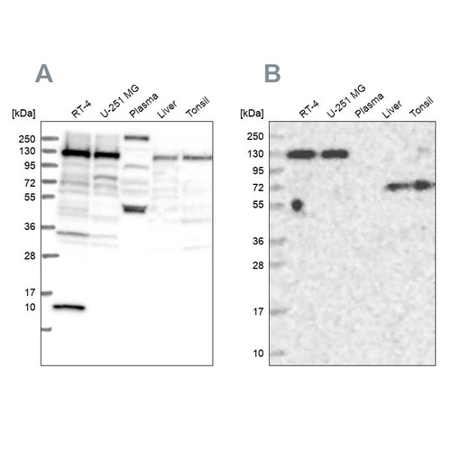 Western blot analysis using Anti-PPP4R1 antibody HPA041089 (A) shows similar pattern to independent antibody HPA040905 (B).
