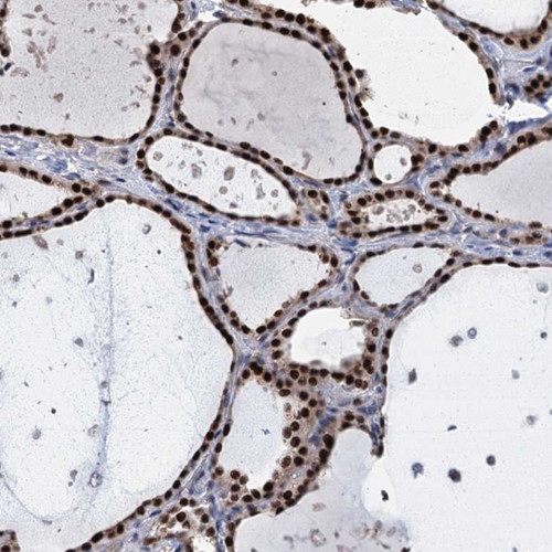 Immunohistochemical staining of human thyroid gland shows strong nuclear positivity in glandular cells.