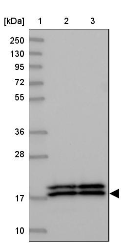 Lane 1: Marker [kDa] 250, 130, 95, 72, 55, 36, 28, 17, 10<br/>Lane 2: Human cell line RT-4<br/>Lane 3: Human cell line U-251MG sp