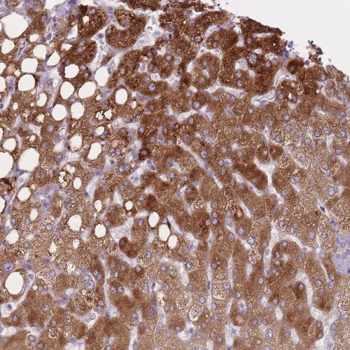 Immunohistochemical staining of human liver shows strong cytoplasmic positivity in hepatocytes .