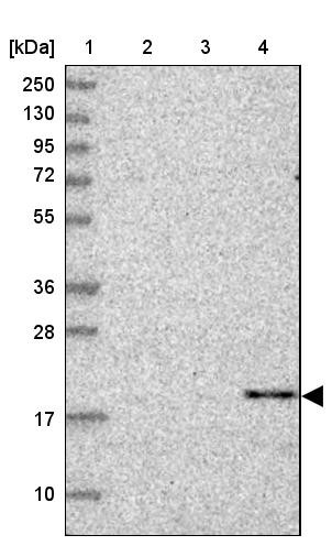 Lane 1: Marker [kDa] 250, 130, 95, 72, 55, 36, 28, 17, 10<br/>Lane 2: Human cell line RT-4<br/>Lane 3: Human cell line U-251MG sp<br/>Lane 4: Human plasma (IgG/HSA depleted)