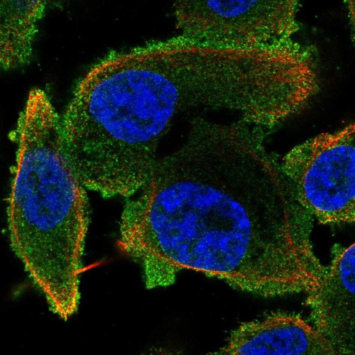 Immunofluorescent staining of human cell line PC-3 shows localization to cytosol.