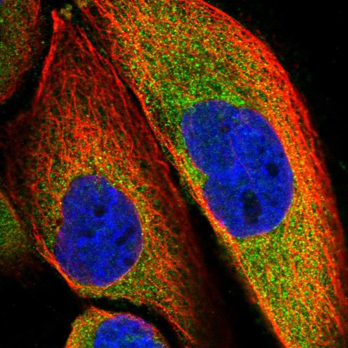 Immunofluorescent staining of human cell line A-431 shows localization to cytosol.