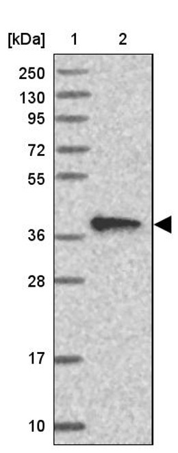 Lane 1: Marker [kDa] 250, 130, 95, 72, 55, 36, 28, 17, 10<br/>Lane 2: Human cell line RT-4
