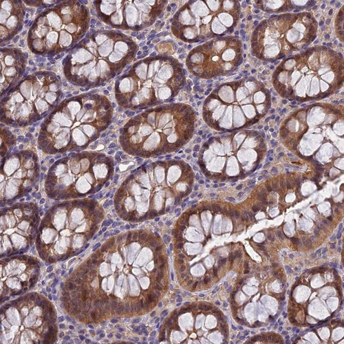 Immunohistochemical staining of human colon shows moderate cytoplasmic and nuclear positivity in glandular cells.