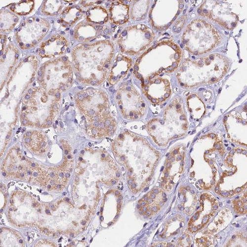 Immunohistochemical staining of human kidney shows moderate cytoplasmic positivity in cells in tubules.