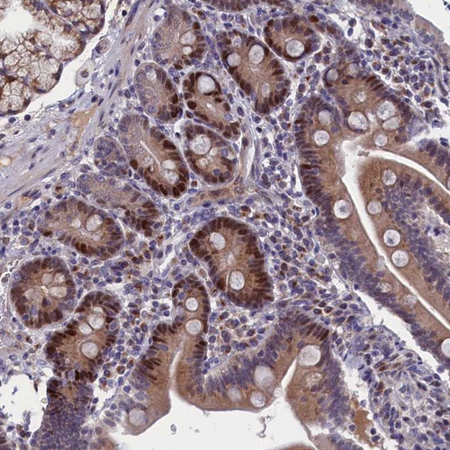 Immunohistochemical staining of human duodenum shows distinct nuclear positivity in glandular cells.