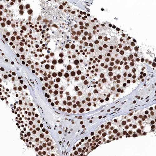 Immunohistochemical staining of human colon shows strong nuclear positivity in glandular cells.