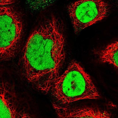 Immunofluorescent staining of human cell line A-431 shows localization to nucleoplasm.