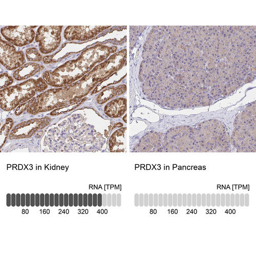 Immunohistochemistry analysis in human kidney and pancreas tissues using Anti-PRDX3 antibody. Corresponding PRDX3 RNA-seq data are presented for the same tissues.