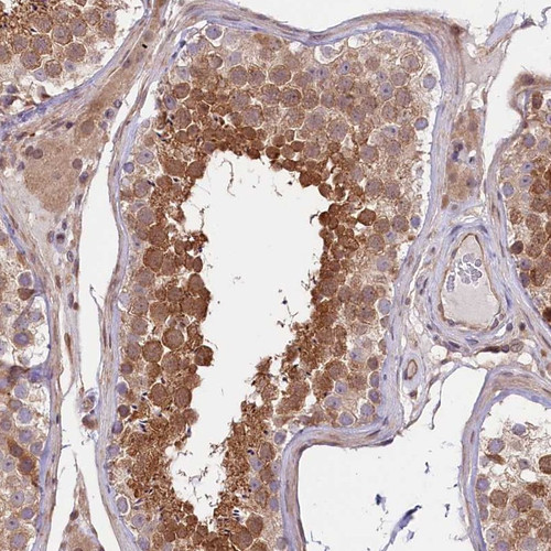 Immunohistochemical staining of human testis shows strong cytoplasmic positivity in cells in seminiferous ducts.