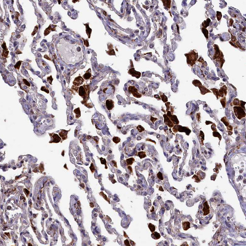 Immunohistochemical staining of human lung shows strong cytoplasmic positivity in macrophages.