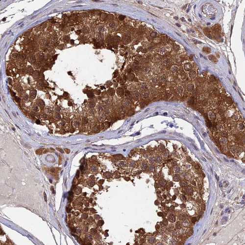 Immunohistochemical staining of human testis shows strong cytoplasmic positivity in cells in seminiferous ducts.