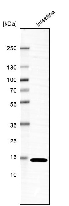 Lane 1: Marker [kDa] 250, 130, 100, 70, 55, 35, 25, 15, 10<br/>Lane 2: Human cell line HL-60