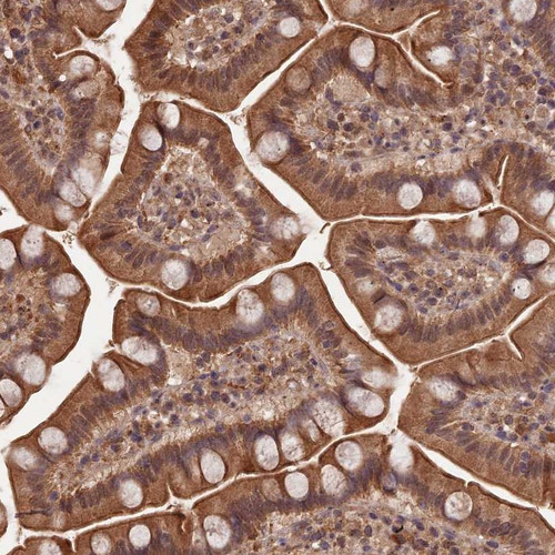 Immunohistochemical staining of human small intestine shows moderate cytoplasmic positivity in glandular cells.