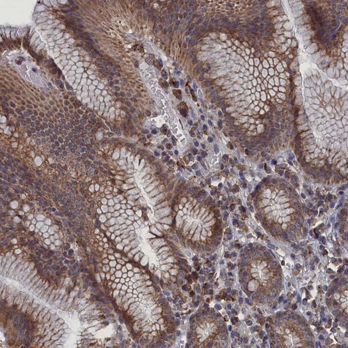 Immunohistochemical staining of human stomach shows moderate cytoplasmic positivity in glandular cells.