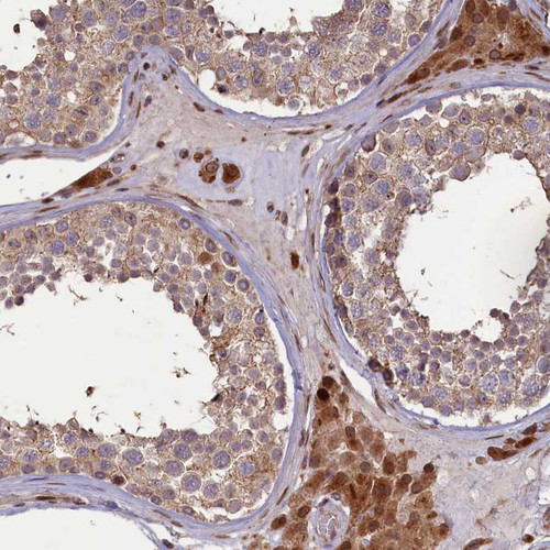 Immunohistochemical staining of human testis shows strong cytoplasmic positivity in Leydig cells.