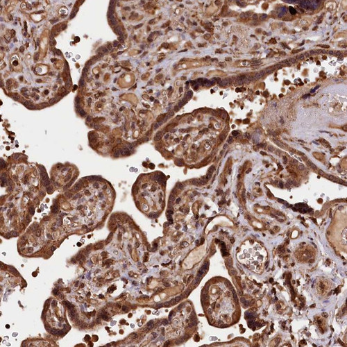Immunohistochemical staining of human placenta shows strong cytoplasmic positivity in trophoblastic cells.