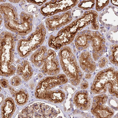 Immunohistochemical staining of human kidney shows strong cytoplasmic and membranous positivity in renal tubules.