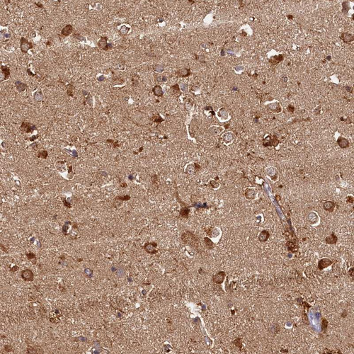 Immunohistochemical staining of human caudate shows strong cytoplasmic positivity in neuronal cells.