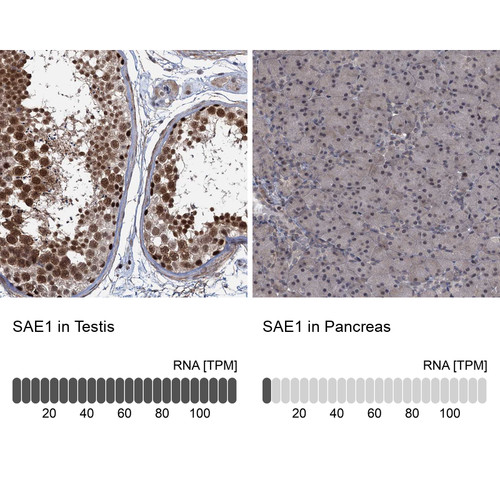 Immunohistochemistry analysis in human testis and pancreas tissues using Anti-SAE1 antibody. Corresponding SAE1 RNA-seq data are presented for the same tissues.