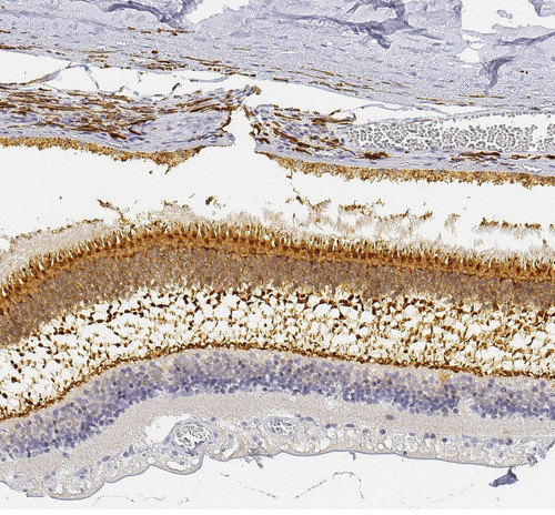 Immunohistochemical staining of human retina shows moderate cytoplasmic positivity in photoreceptor cells and outer plexiform layer.