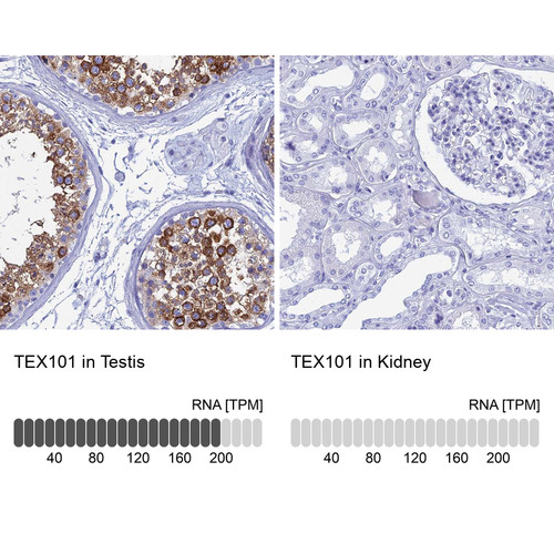 Immunohistochemistry analysis in human testis and kidney tissues using Anti-TEX101 antibody. Corresponding TEX101 RNA-seq data are presented for the same tissues.