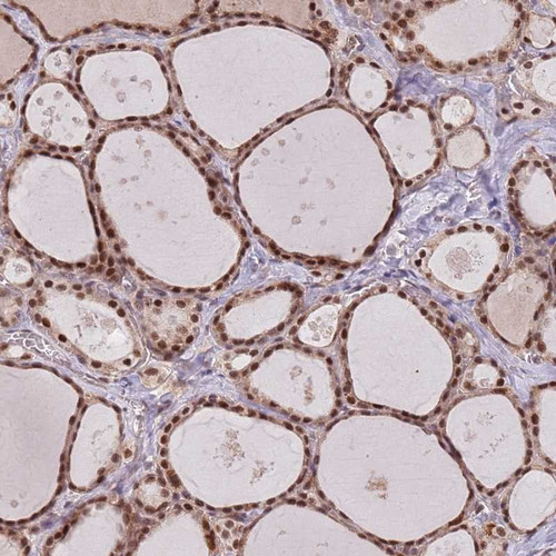 Immunohistochemical staining of human thyroid gland shows strong nuclear positivity in glandular cells.