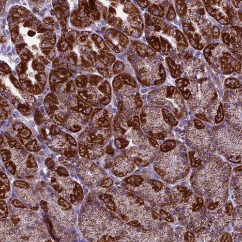 Immunohistochemical staining of human stomach, lower shows strong granular cytoplasmic positivity in glandular cells.