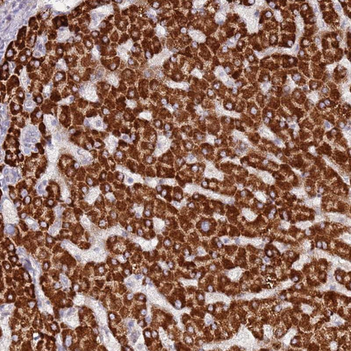 Immunohistochemical staining of human liver shows strong cytoplasmic positivity in hepatocytes.