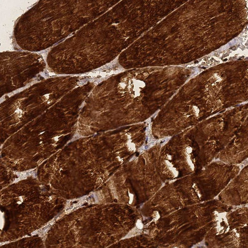 Immunohistochemical staining of human skeletal muscle shows strong cytoplasmic and nuclear positivity in myocytes.