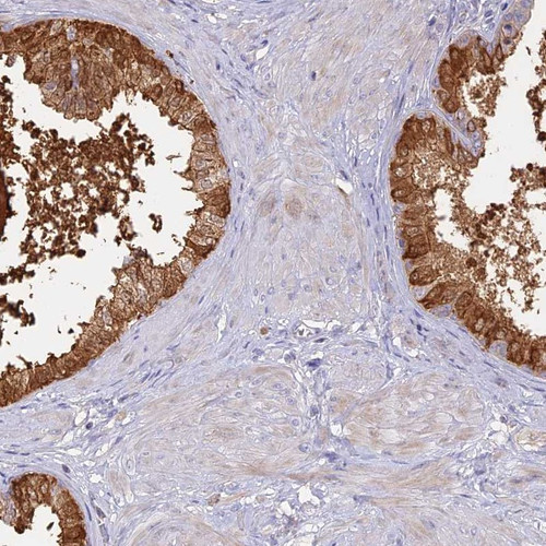 Immunohistochemical staining of human prostate shows strong cytoplasmic positivity in glandular cells.