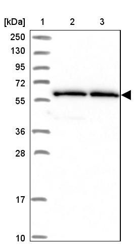 Lane 1: Marker [kDa] 250, 130, 95, 72, 55, 36, 28, 17, 10<br/>Lane 2: Human cell line RT-4<br/>Lane 3: Human cell line U-251MG sp