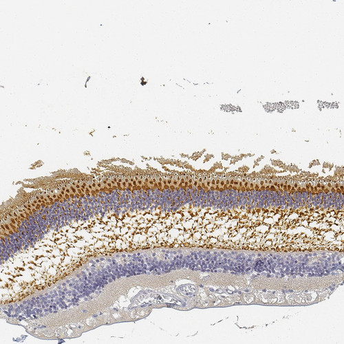 Immunohistochemical staining of human retina shows strong positivity in cones and in outer plexiform layer.