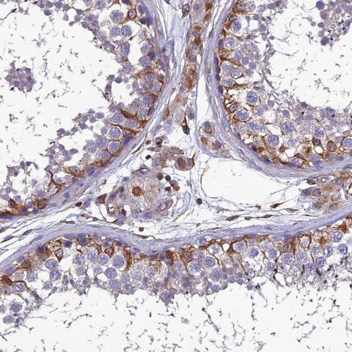 Immunohistochemical staining of human testis shows cytoplasmic positivity in basal cells.