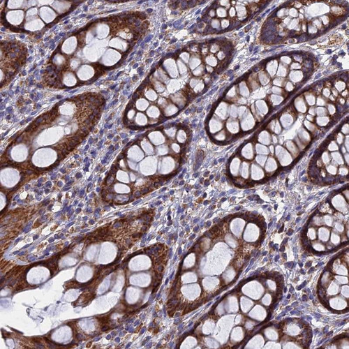 Immunohistochemical staining of human rectum shows strong cytoplasmic positivity in glandular cells.