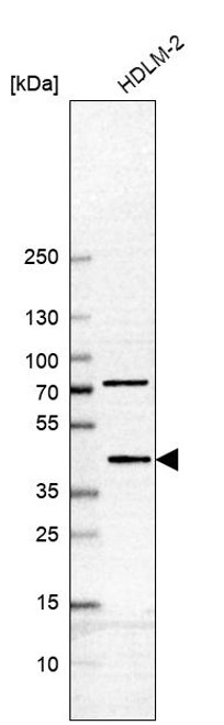 Western blot analysis in human cell line HDLM-2.