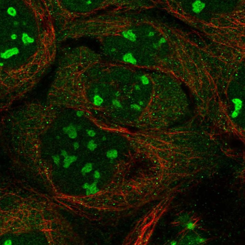 Immunofluorescent staining of human cell line A-431 shows localization to nucleoli.