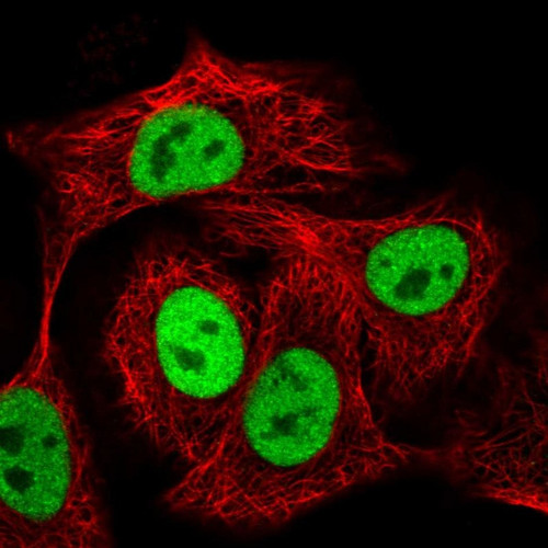 Immunofluorescent staining of human cell line A549 shows localization to nucleoplasm.