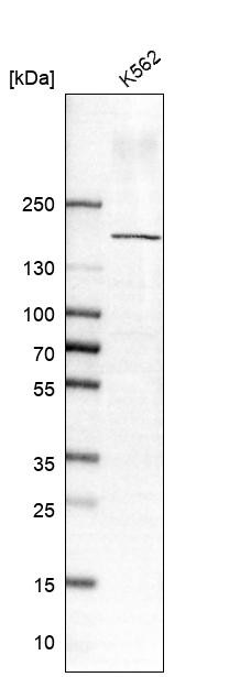Western blot analysis in human cell line K562.