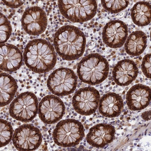 Immunohistochemical staining of human colon shows strong cytoplasmic and nuclear positivity in glandular cells.